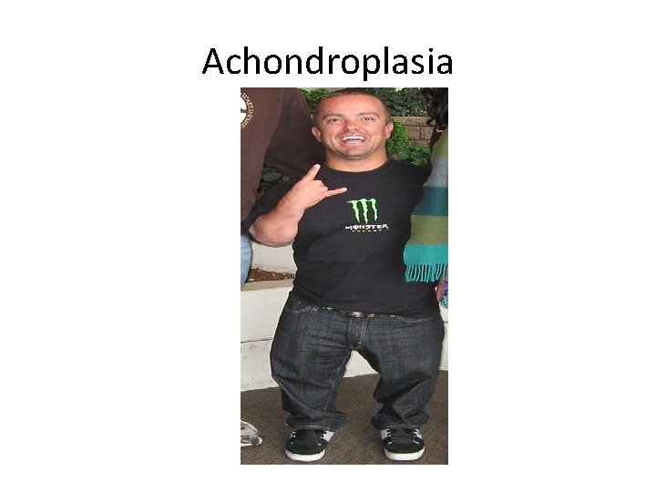 Achondroplasia 