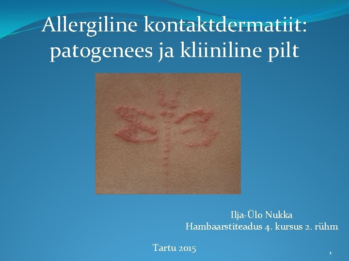 Allergiline kontaktdermatiit: patogenees ja kliiniline pilt Ilja-Ülo Nukka Hambaarstiteadus 4. kursus 2. rühm Tartu