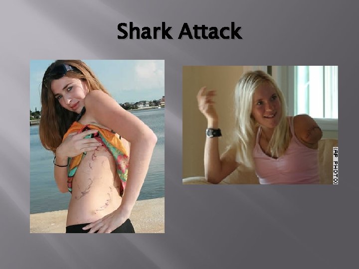 Shark Attack 