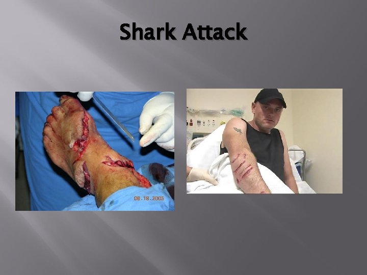 Shark Attack 