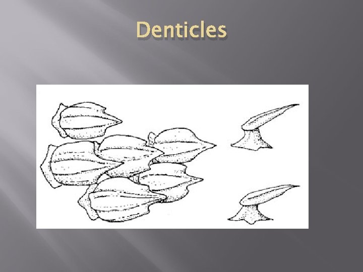 Denticles 