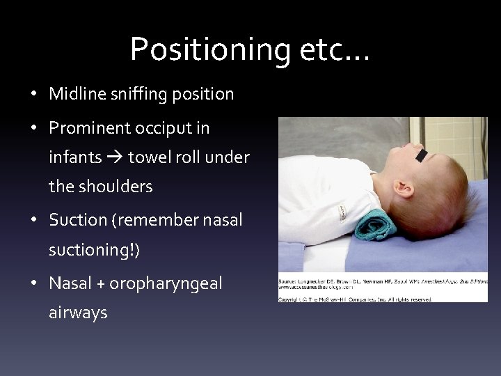 Positioning etc… • Midline sniffing position • Prominent occiput in infants towel roll under Positioning etc… • Midline sniffing position • Prominent occiput in infants towel roll under