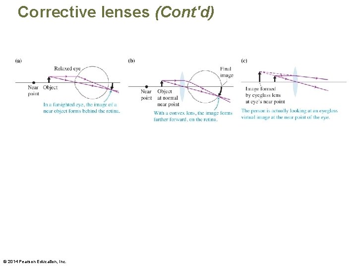 Corrective lenses (Cont'd) © 2014 Pearson Education, Inc. 