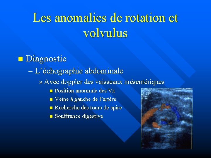 Les anomalies de rotation et volvulus n Diagnostic – L’échographie abdominale » Avec doppler