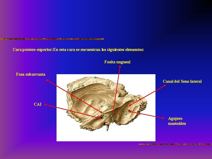 Cara póstero-superior: En esta cara se encuentran los siguientes elementos: Fosita ungueal Fosa subarcuata