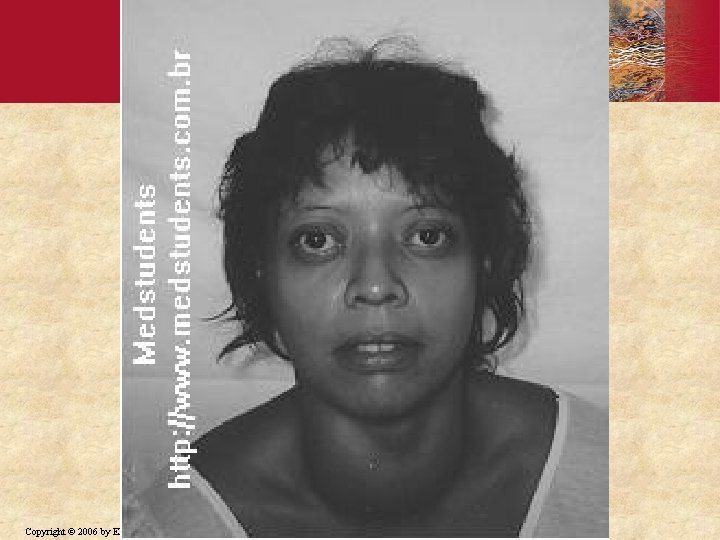 Copyright © 2006 by Elsevier, Inc. 