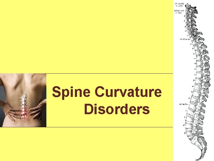 Spine Curvature Disorders 