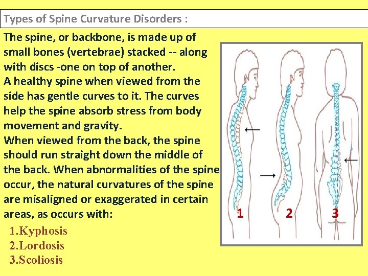 Types of Spine Curvature Disorders : The spine, or backbone, is made up of