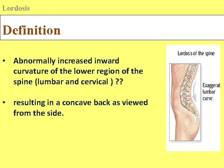 Lordosis Definition • Abnormally increased inward curvature of the lower region of the spine