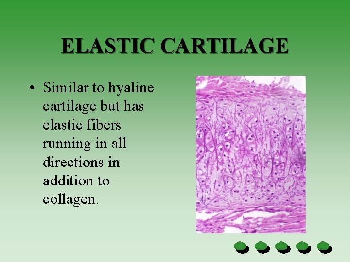 ELASTIC CARTILAGE • Similar to hyaline cartilage but has elastic fibers running in all