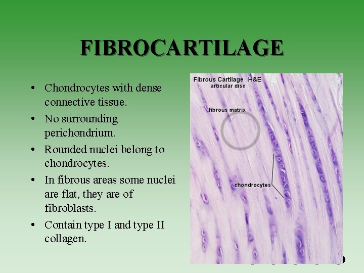 FIBROCARTILAGE • Chondrocytes with dense connective tissue. • No surrounding perichondrium. • Rounded nuclei