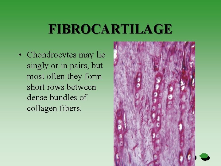 FIBROCARTILAGE • Chondrocytes may lie singly or in pairs, but most often they form