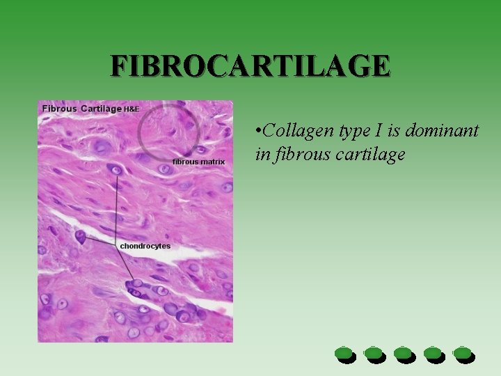 FIBROCARTILAGE • Collagen type I is dominant in fibrous cartilage 