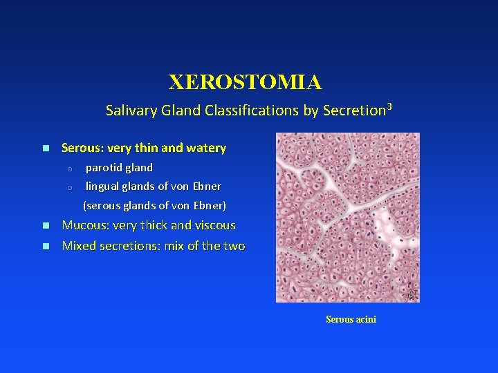 XEROSTOMIA Salivary Gland Classifications by Secretion 3 n Serous: very thin and watery o