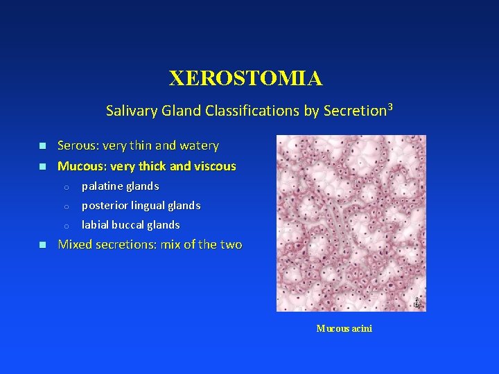 XEROSTOMIA Salivary Gland Classifications by Secretion 3 n n Serous: very thin and watery