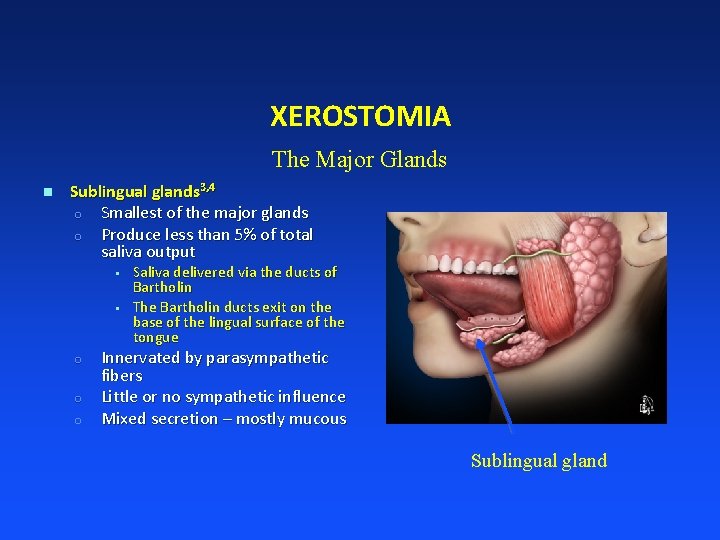 XEROSTOMIA The Major Glands n Sublingual glands 3, 4 o Smallest of the major