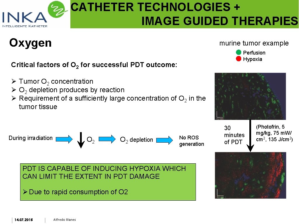 CATHETER TECHNOLOGIES + IMAGE GUIDED THERAPIES Oxygen murine tumor example Perfusion Hypoxia Critical factors