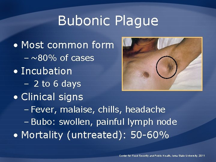 Bubonic Plague • Most common form – ~80% of cases • Incubation – 2