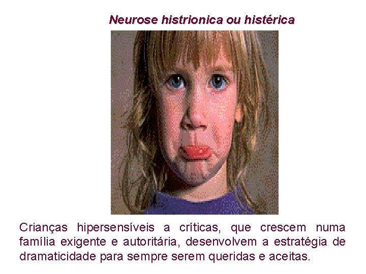 Neurose histrionica ou histérica Crianças hipersensíveis a críticas, que crescem numa família exigente e