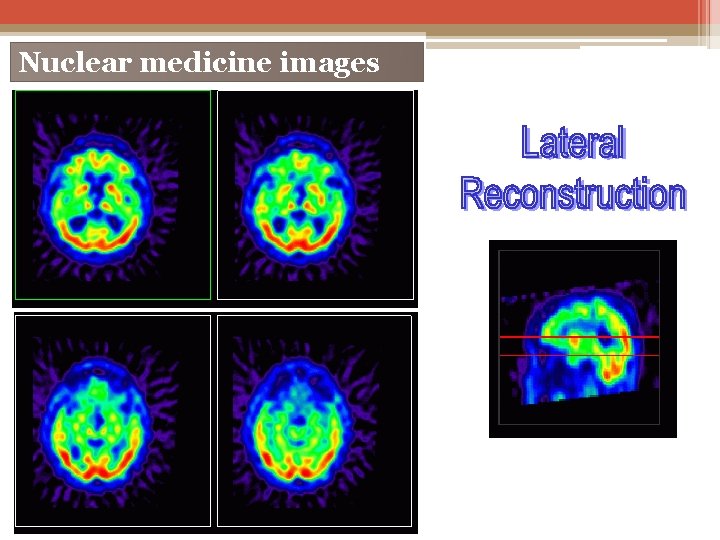 Nuclear medicine images 