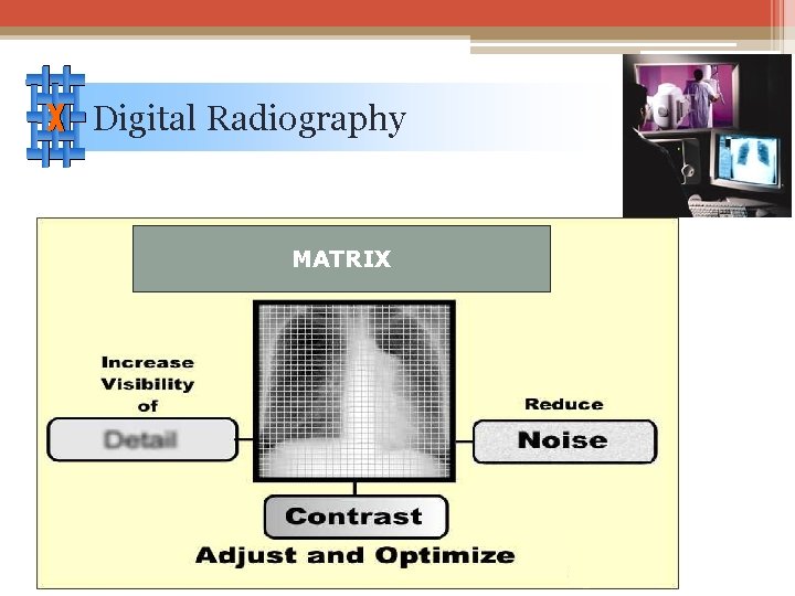 Digital Radiography MATRIX 