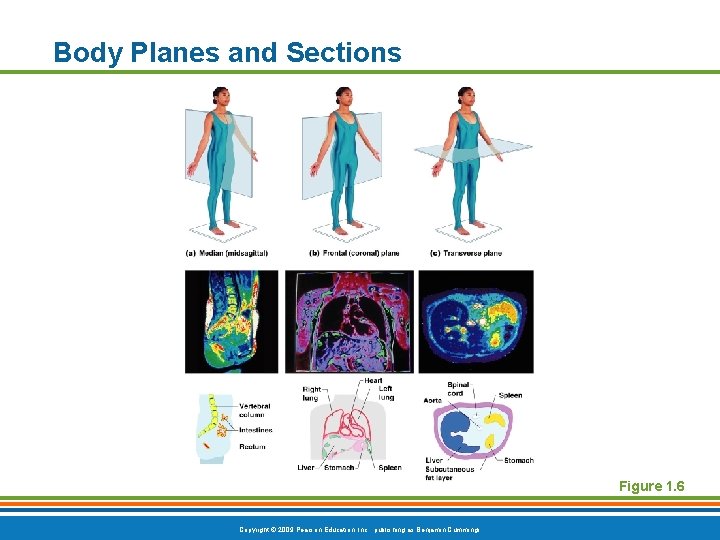 Body Planes and Sections Figure 1. 6 Copyright © 2009 Pearson Education, Inc. ,