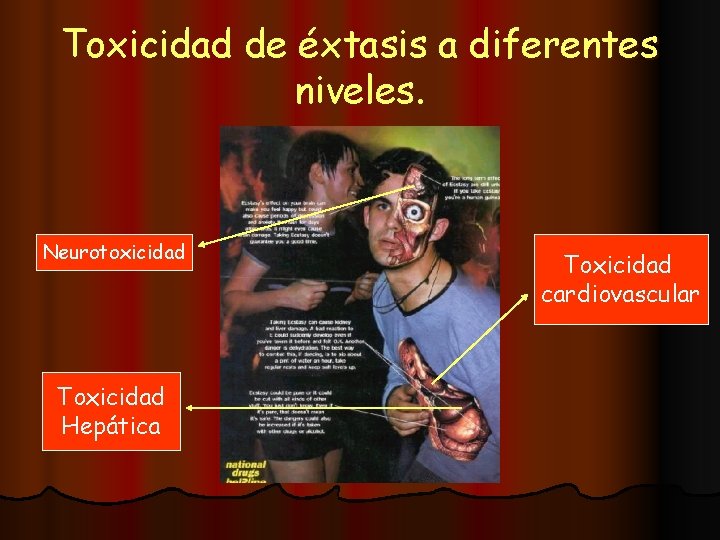 Toxicidad de éxtasis a diferentes niveles. Neurotoxicidad Toxicidad Hepática Toxicidad cardiovascular 