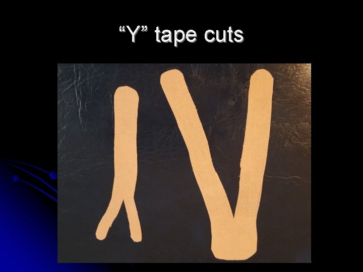 “Y” tape cuts 