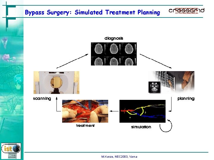 Bypass Surgery: Simulated Treatment Planning M. Kunze, NEC 2003, Varna 