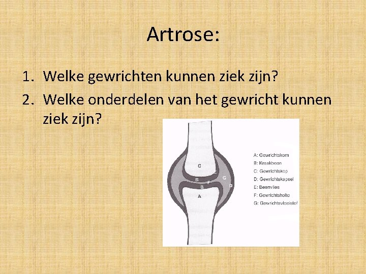 Artrose: 1. Welke gewrichten kunnen ziek zijn? 2. Welke onderdelen van het gewricht kunnen