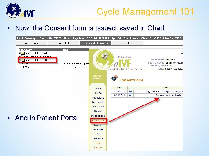 Cycle Management 101 • Now, the Consent form is Issued, saved in Chart •