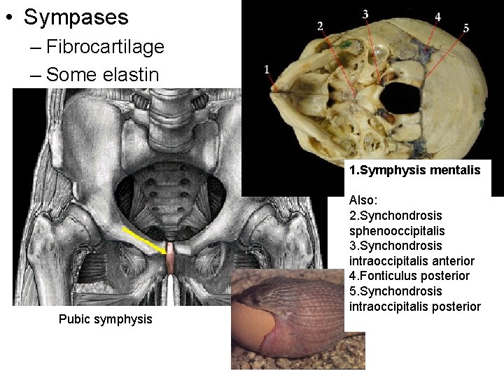  • Sympases – Fibrocartilage – Some elastin 1. Symphysis mentalis Pubic symphysis Also: