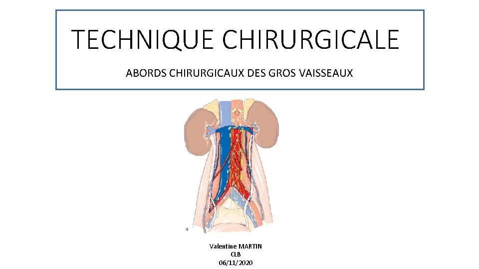 TECHNIQUE CHIRURGICALE ABORDS CHIRURGICAUX DES GROS VAISSEAUX Valentine MARTIN CLB 06/11/2020 