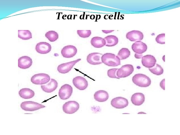Tear drop cells 