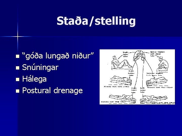 Staða/stelling “góða lungað niður” n Snúningar n Hálega n Postural drenage n 