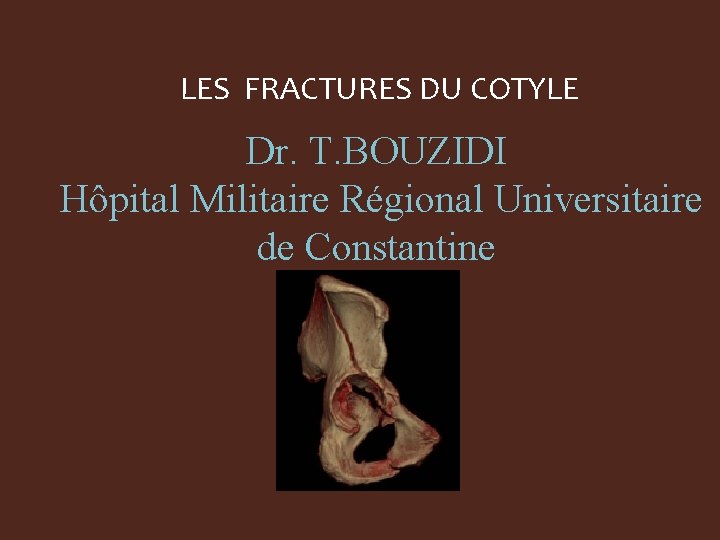 LES FRACTURES DU COTYLE Dr. T. BOUZIDI Hôpital Militaire Régional Universitaire de Constantine 