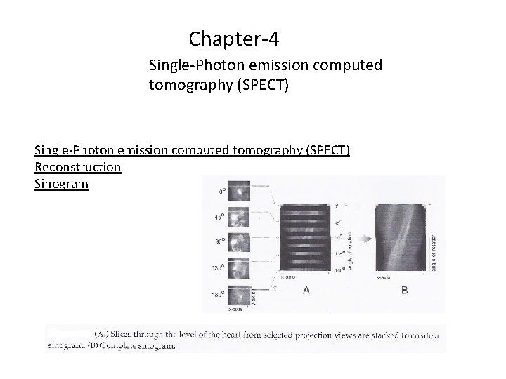 Chapter-4 Single-Photon emission computed tomography (SPECT) Reconstruction Sinogram 