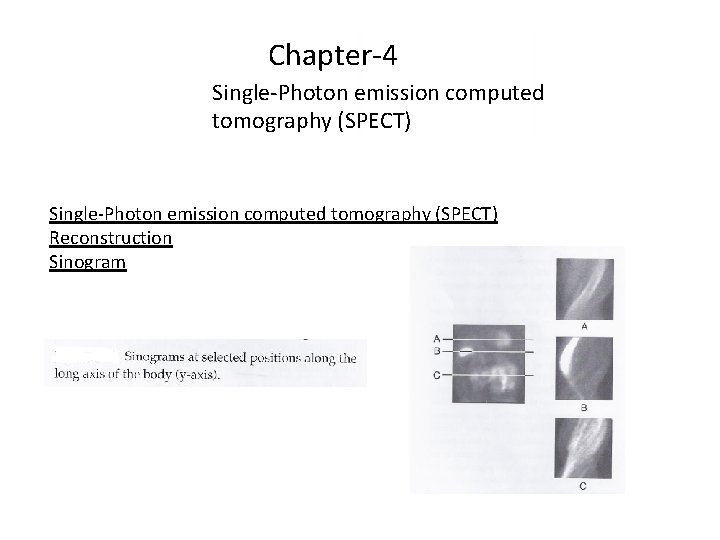 Chapter-4 Single-Photon emission computed tomography (SPECT) Reconstruction Sinogram 