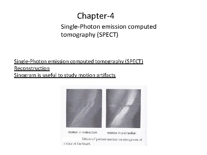 Chapter-4 Single-Photon emission computed tomography (SPECT) Reconstruction Sinogram is useful to study motion artifacts