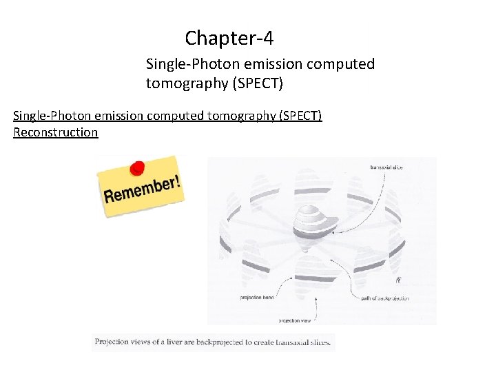 Chapter-4 Single-Photon emission computed tomography (SPECT) Reconstruction 