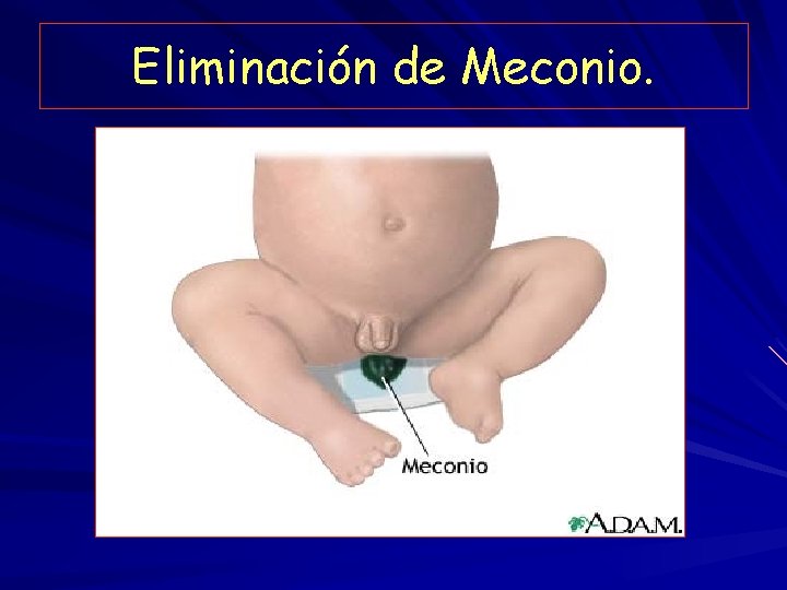 Eliminación de Meconio. 