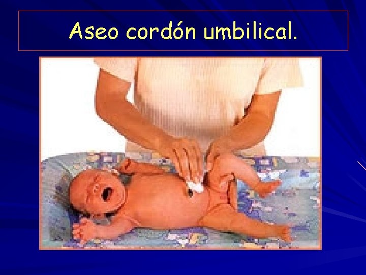 Aseo cordón umbilical. 