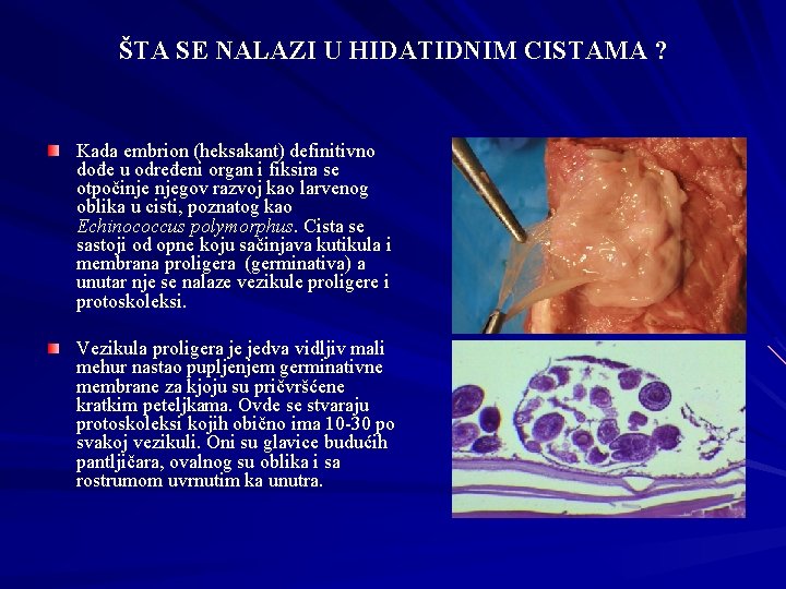 ŠTA SE NALAZI U HIDATIDNIM CISTAMA ? Kada embrion (heksakant) definitivno dođe u određeni