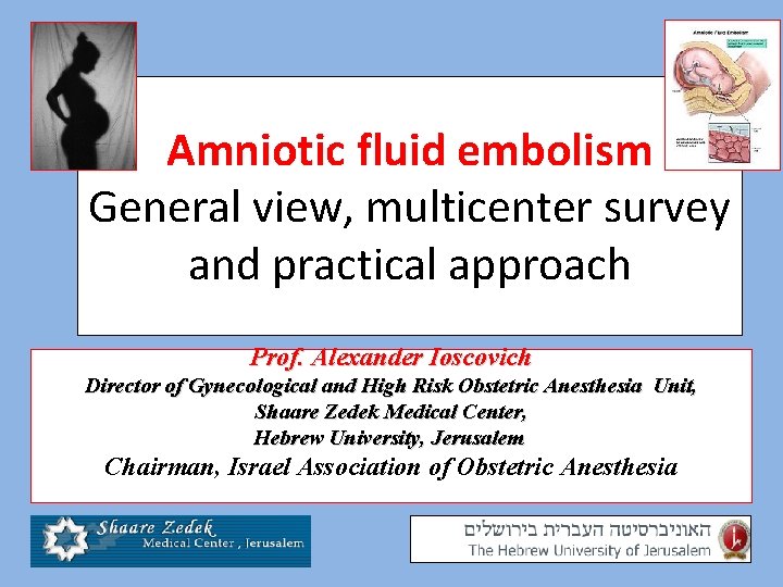 Amniotic fluid embolism General view, multicenter survey and practical approach Prof. Alexander Ioscovich Director