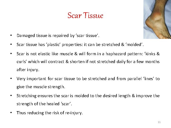 Scar Tissue • Damaged tissue is repaired by ‘scar tissue’. • Scar tissue has