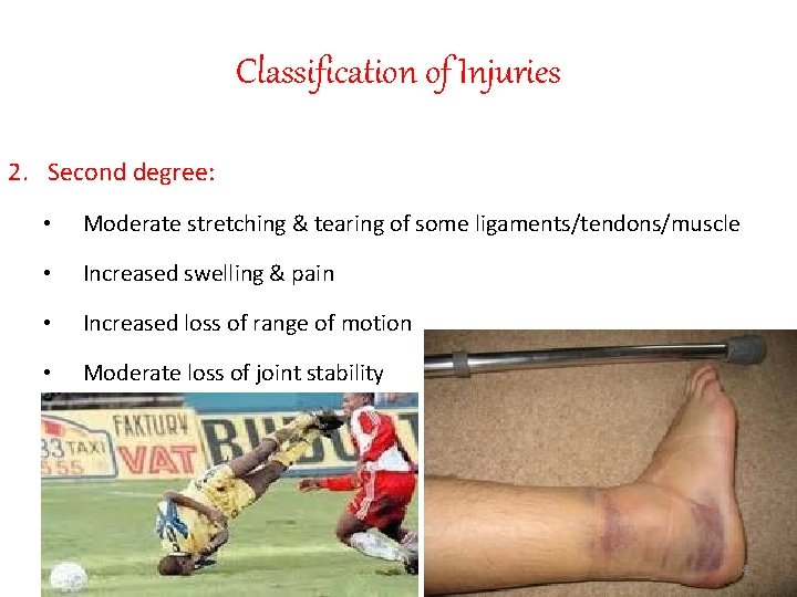 Classification of Injuries 2. Second degree: • Moderate stretching & tearing of some ligaments/tendons/muscle