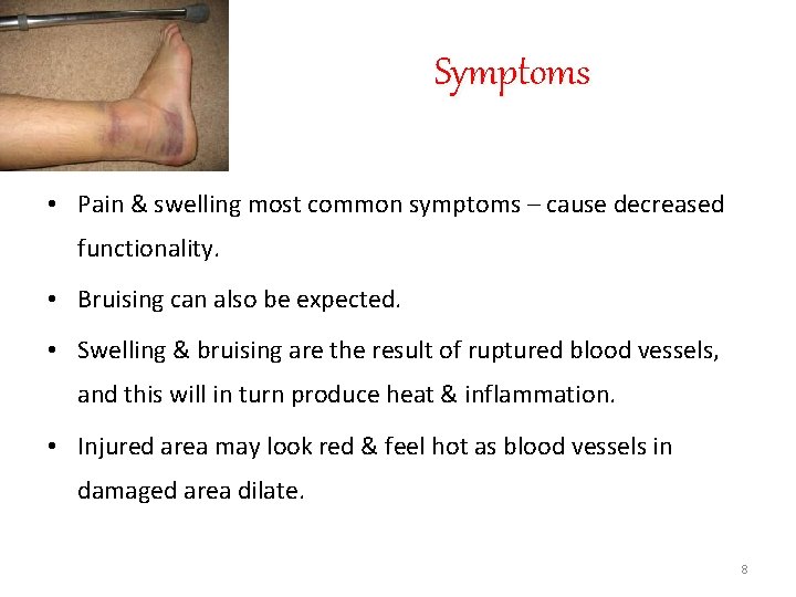 Symptoms • Pain & swelling most common symptoms – cause decreased functionality. • Bruising