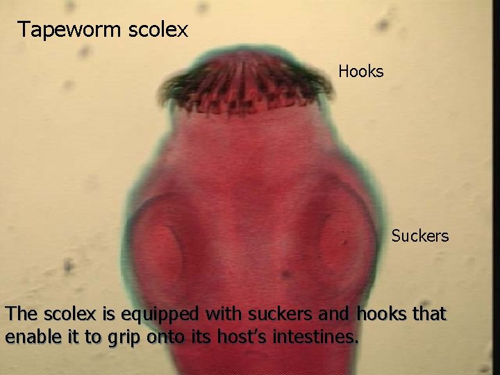 Tapeworm scolex Hooks Suckers The scolex is equipped with suckers and hooks that enable