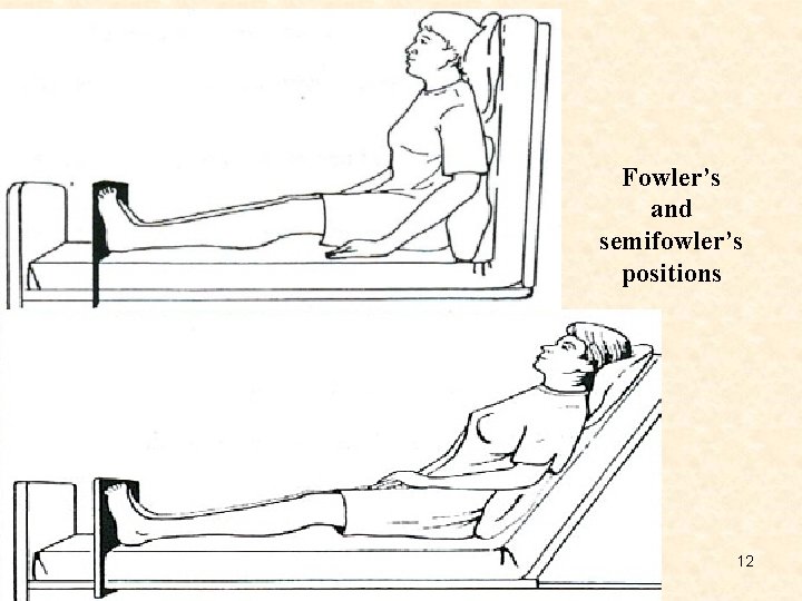 Fowler’s and semifowler’s positions 12 