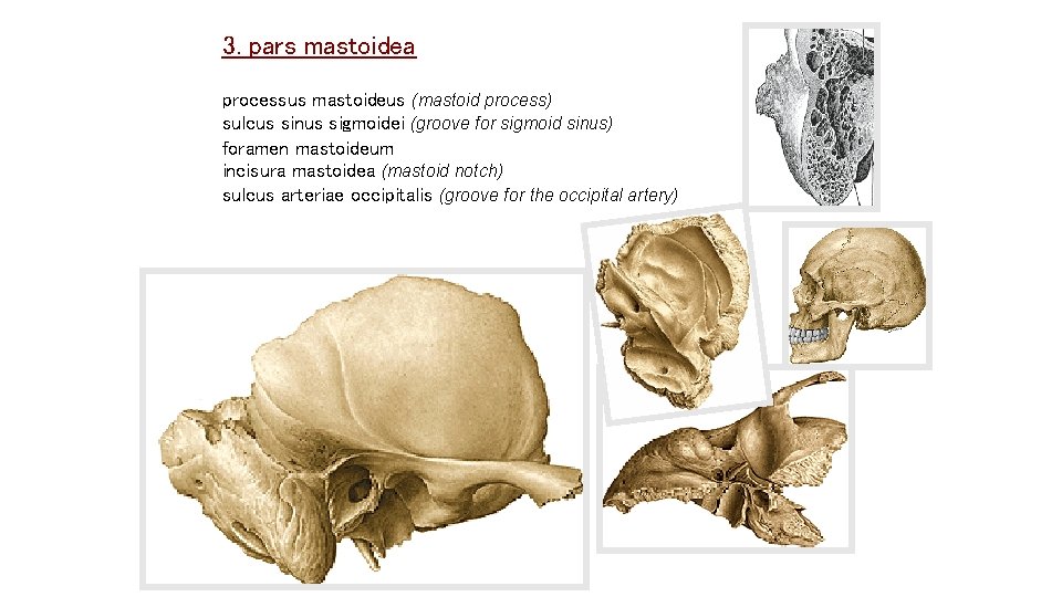 3. pars mastoidea processus mastoideus (mastoid process) sulcus sinus sigmoidei (groove for sigmoid sinus) 3. pars mastoidea processus mastoideus (mastoid process) sulcus sinus sigmoidei (groove for sigmoid sinus)